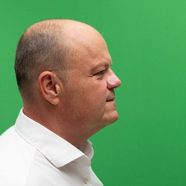 Orrtapasz alváshoz: tényleg segít, hogy jobban lélegezz és kevesebbet horkolj?